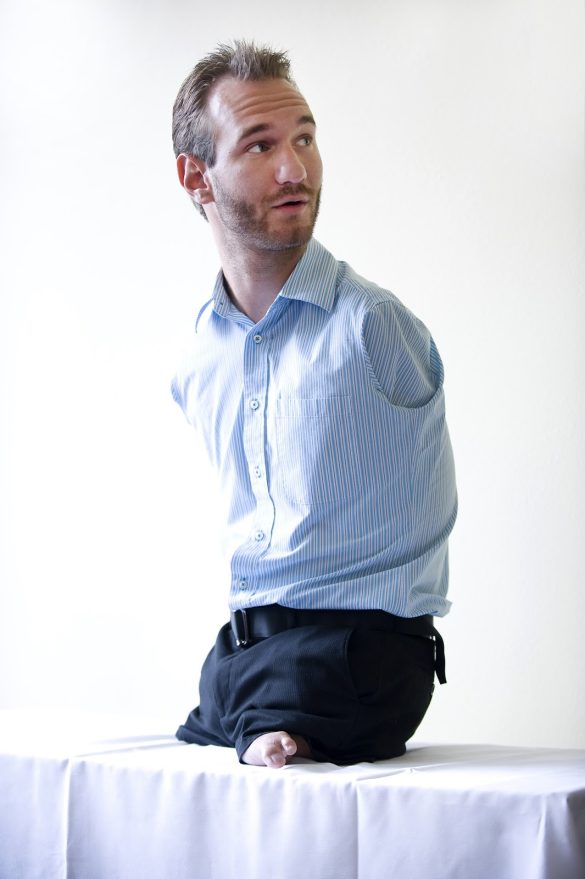 No Arms, No Legs, No ProblemWith Jesus Greg Lancaster Ministries